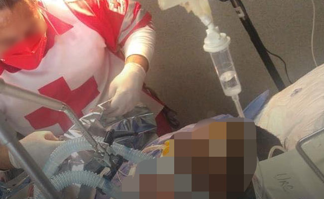 ¡Albañil se ELECTROCUTA!, ahora lucha por su VIDA en hospital de Matamoros